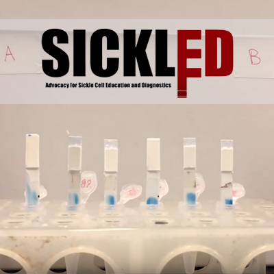 Sickled Advocacy for Sickle Cell Education and Diagnosis, courtesy of Sickled Challenge Team at Lehigh University